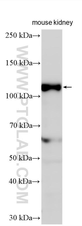 Western Blot (WB) analysis of various lysates using STOX2 Polyclonal antibody (32724-1-AP)
