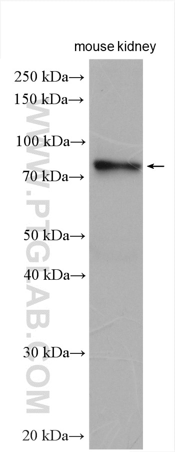 Western Blot (WB) analysis of various lysates using STRA6 Polyclonal antibody (22001-1-AP)