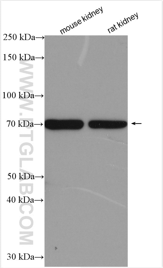 Western Blot (WB) analysis of various lysates using STRA6 Polyclonal antibody (22001-1-AP)