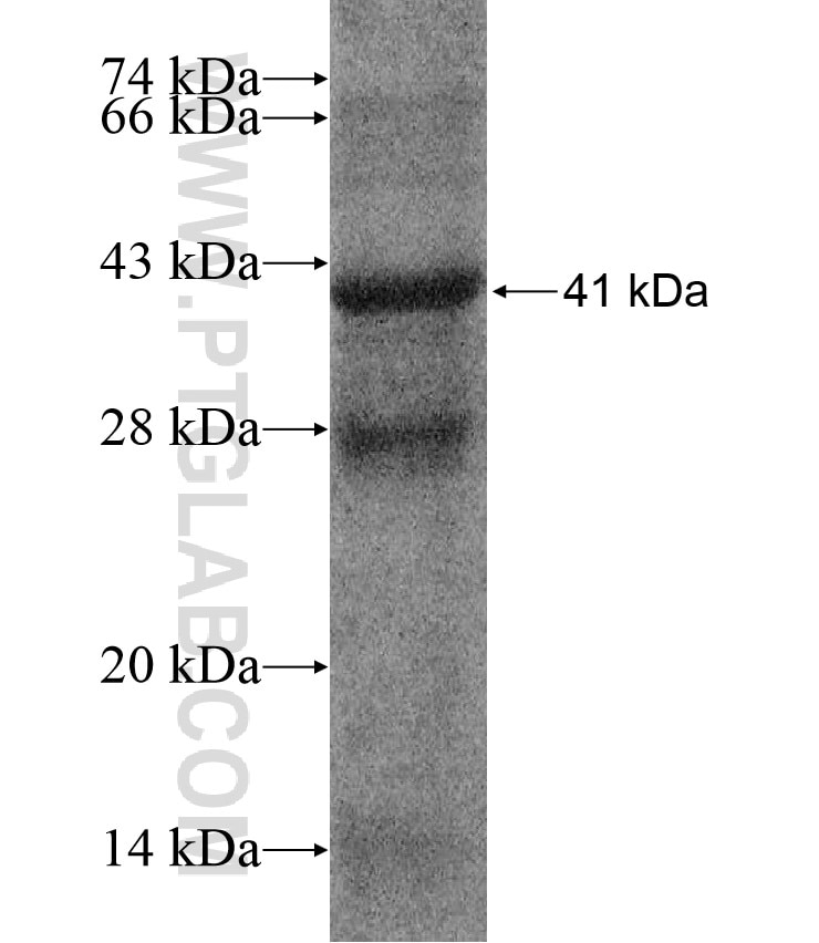 STRA6 fusion protein Ag17591 SDS-PAGE
