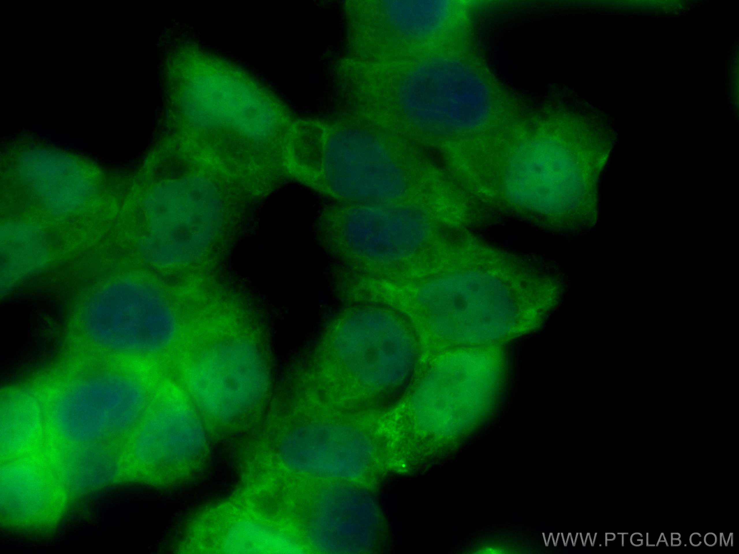 Immunofluorescence (IF) / fluorescent staining of NCCIT cells using CoraLite® Plus 488-conjugated STRA8 Monoclonal ant (CL488-68071)