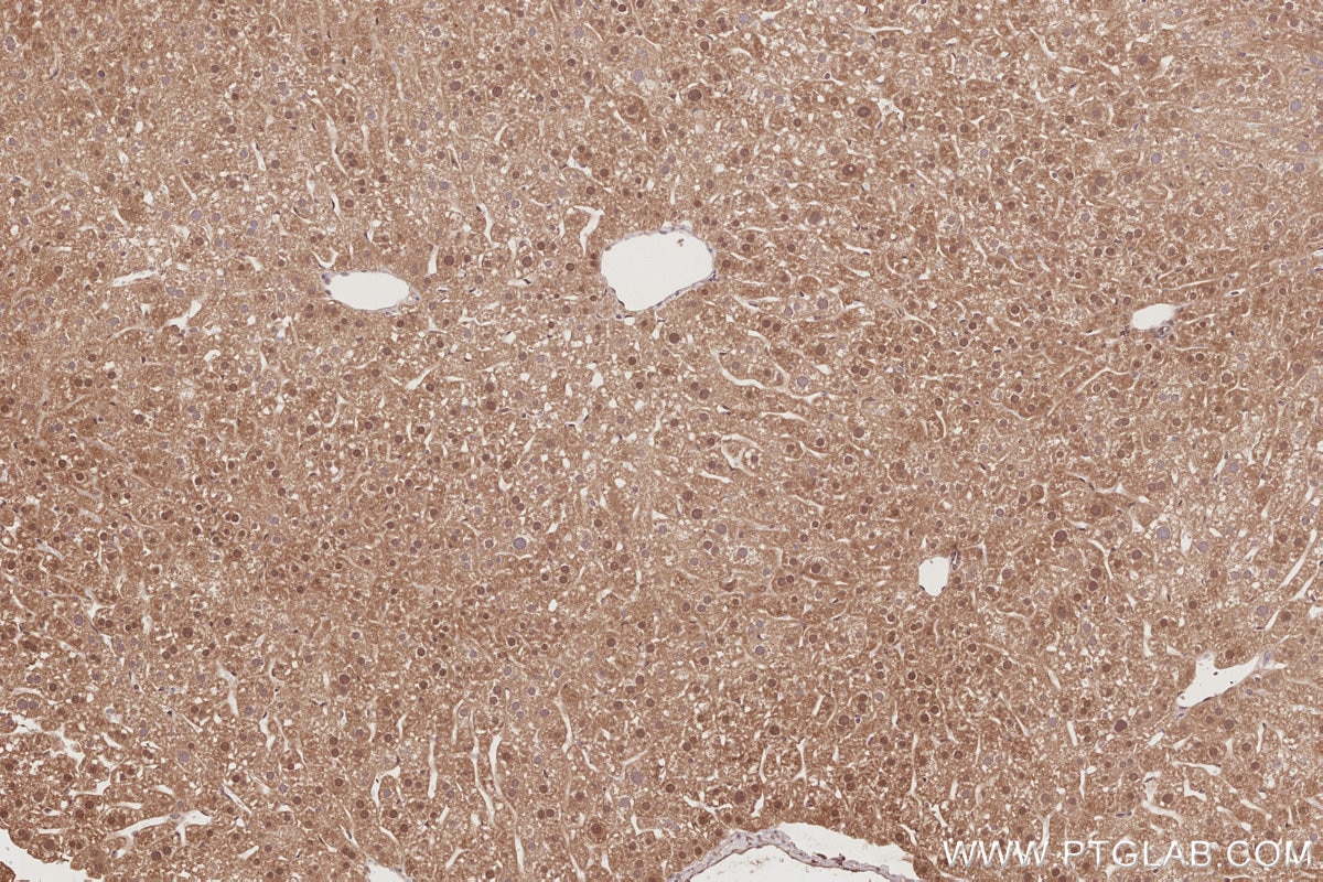 Immunohistochemistry (IHC) staining of mouse liver tissue using STRADB Polyclonal antibody (10688-1-AP)
