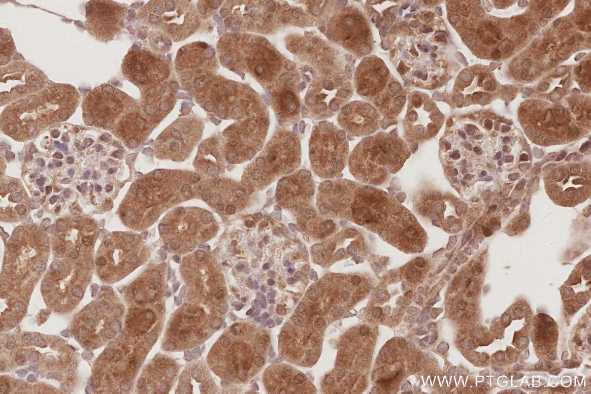 Immunohistochemistry (IHC) staining of mouse kidney tissue using STRADB Polyclonal antibody (10688-1-AP)
