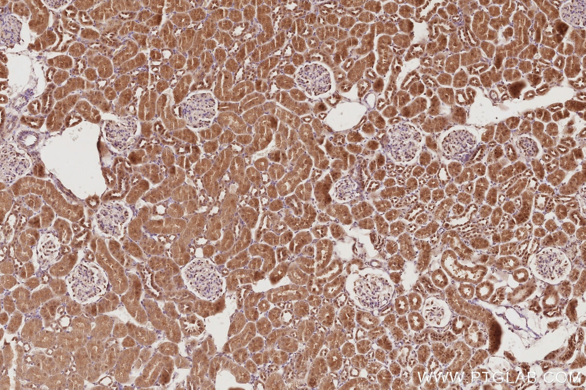 Immunohistochemistry (IHC) staining of rat kidney tissue using STRADB Polyclonal antibody (10688-1-AP)