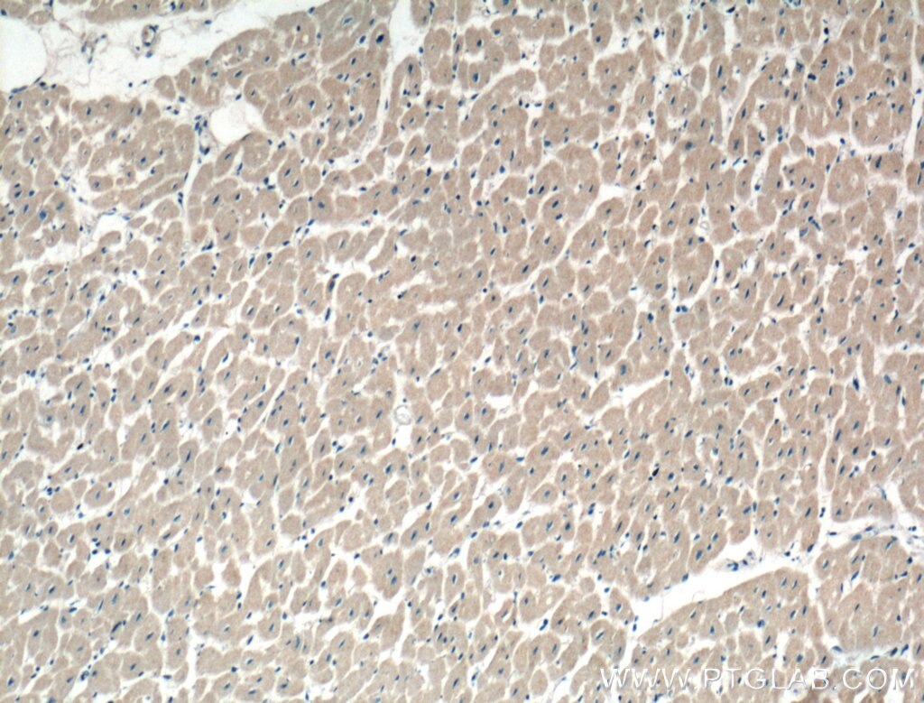 Immunohistochemistry (IHC) staining of human heart tissue using STRADB Polyclonal antibody (10688-1-AP)