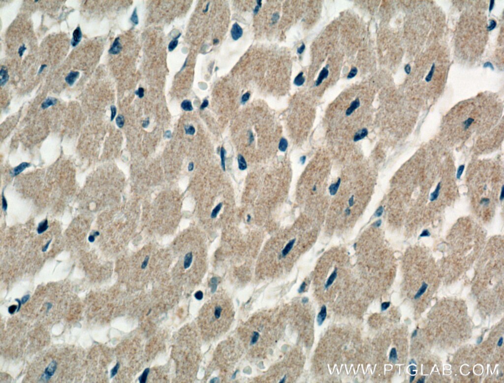Immunohistochemistry (IHC) staining of human heart tissue using STRADB Polyclonal antibody (10688-1-AP)