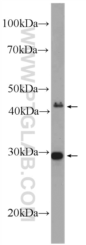 Western Blot (WB) analysis of mouse heart tissue using STRADB Polyclonal antibody (10688-1-AP)