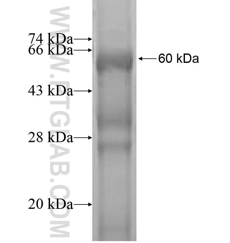 STRADB fusion protein Ag1040 SDS-PAGE