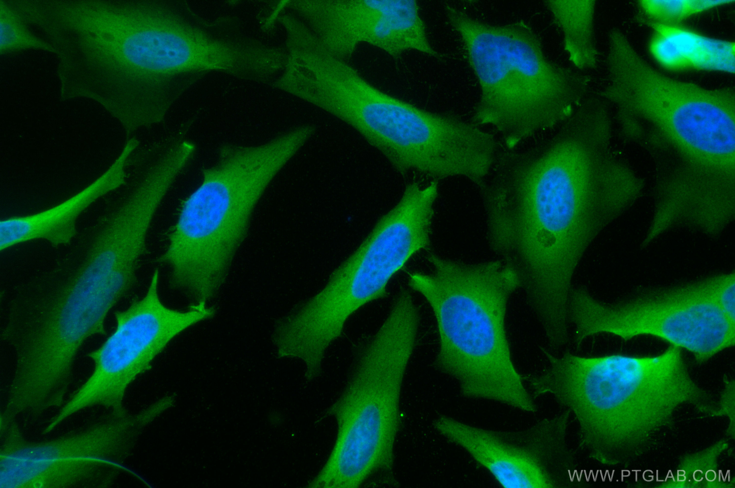 Immunofluorescence (IF) / fluorescent staining of HeLa cells using STRAP Polyclonal antibody (18277-1-AP)