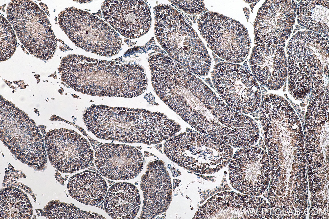 Immunohistochemistry (IHC) staining of mouse testis tissue using STRAP Polyclonal antibody (18277-1-AP)