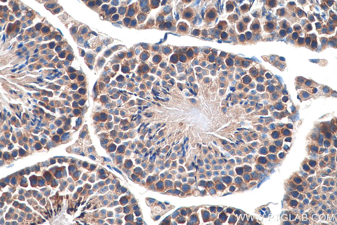 IHC staining of mouse testis using 18277-1-AP