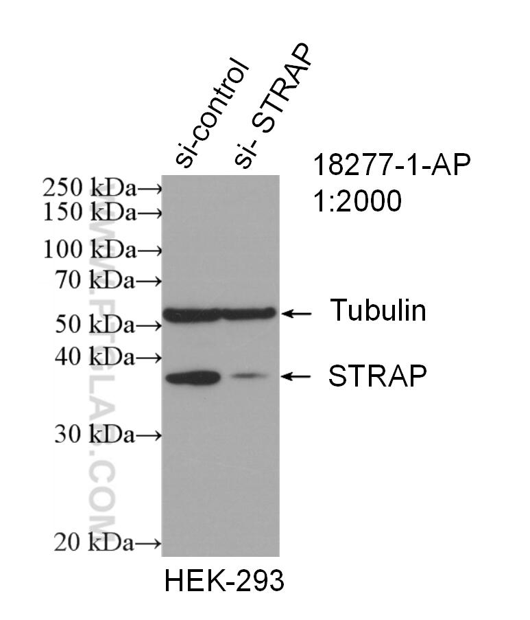 Western Blot (WB) analysis of HEK-293 cells using STRAP Polyclonal antibody (18277-1-AP)