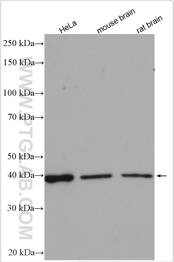 Western Blot (WB) analysis of various lysates using STRAP Polyclonal antibody (18277-1-AP)