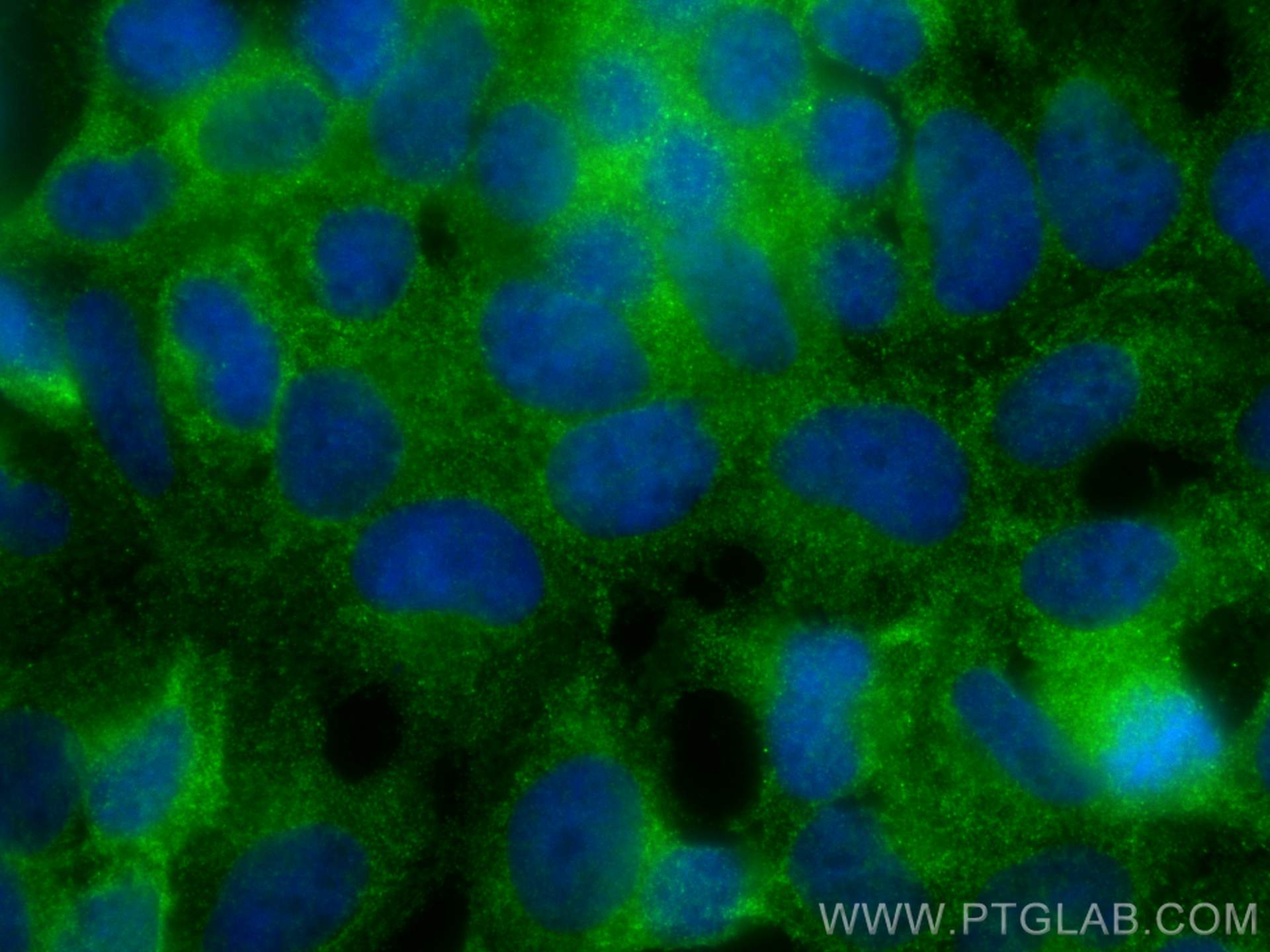 Immunofluorescence (IF) / fluorescent staining of HEK-293 cells using STRAP Monoclonal antibody (66712-1-Ig)