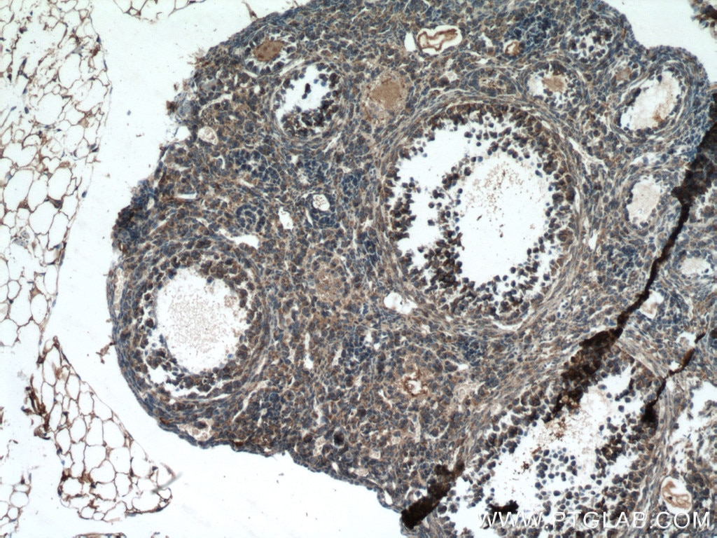 Immunohistochemistry (IHC) staining of mouse ovary tissue using STRAP Monoclonal antibody (66712-1-Ig)