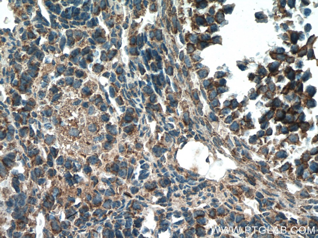 Immunohistochemistry (IHC) staining of mouse ovary tissue using STRAP Monoclonal antibody (66712-1-Ig)