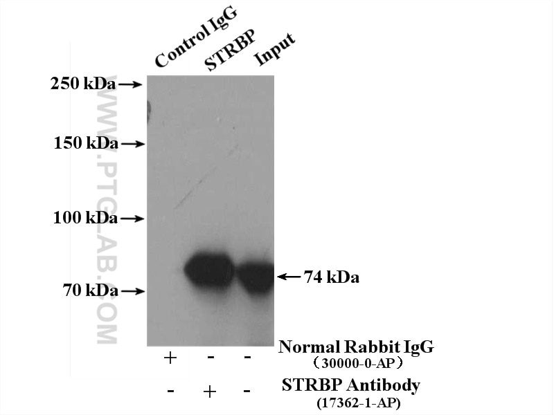 Immunoprecipitation (IP) experiment of PC-3 cells using STRBP Polyclonal antibody (17362-1-AP)
