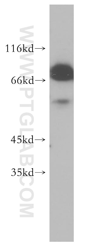 Western Blot (WB) analysis of mouse testis tissue using STRBP Polyclonal antibody (17362-1-AP)