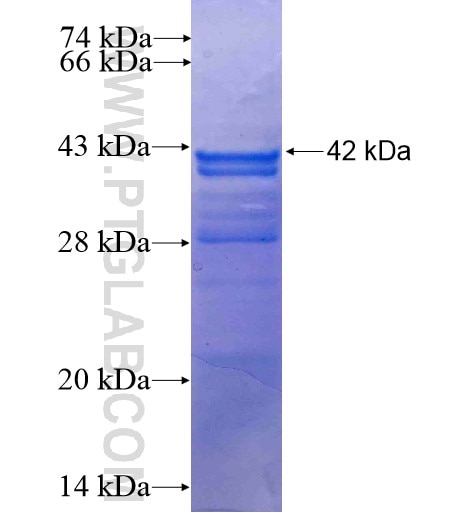 STRBP fusion protein Ag10650 SDS-PAGE