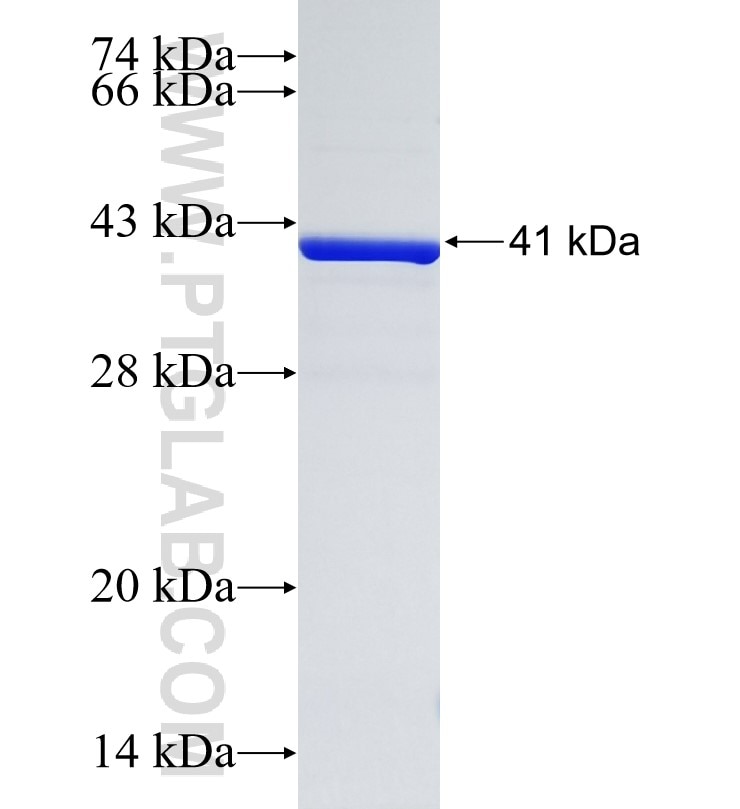 STRC fusion protein Ag34771 SDS-PAGE STRC fusion protein Ag34771 SDS-PAGE