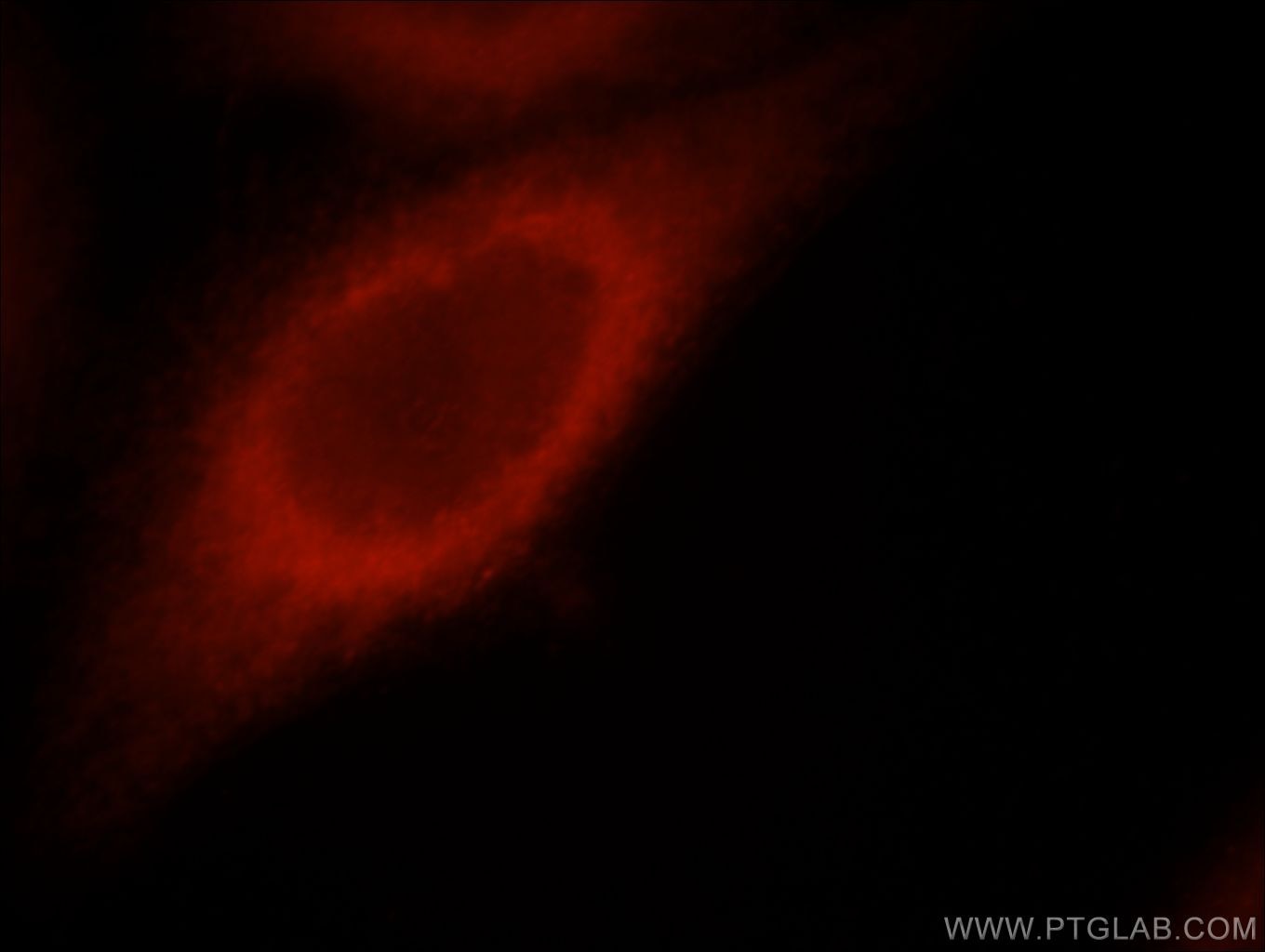Immunofluorescence (IF) / fluorescent staining of HeLa cells using STRN Polyclonal antibody (21624-1-AP)