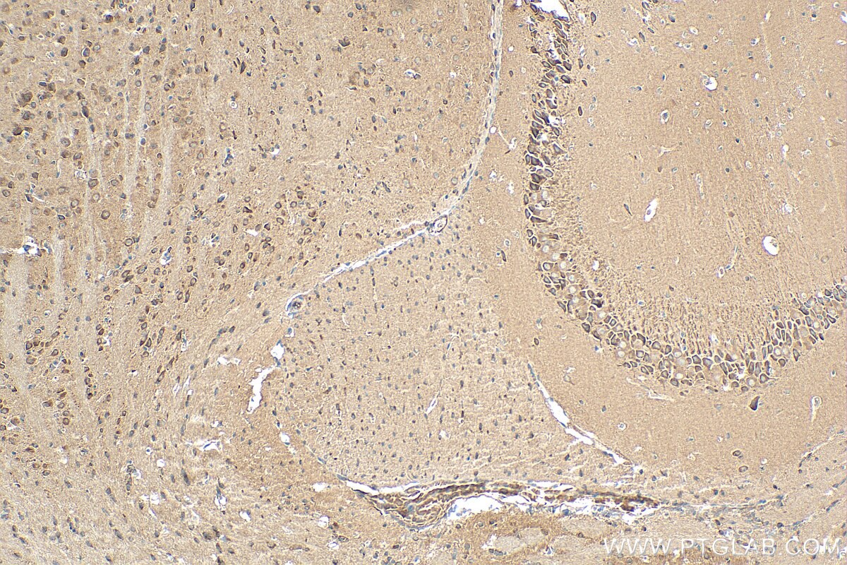 Immunohistochemistry (IHC) staining of mouse brain tissue using STRN Polyclonal antibody (21624-1-AP)