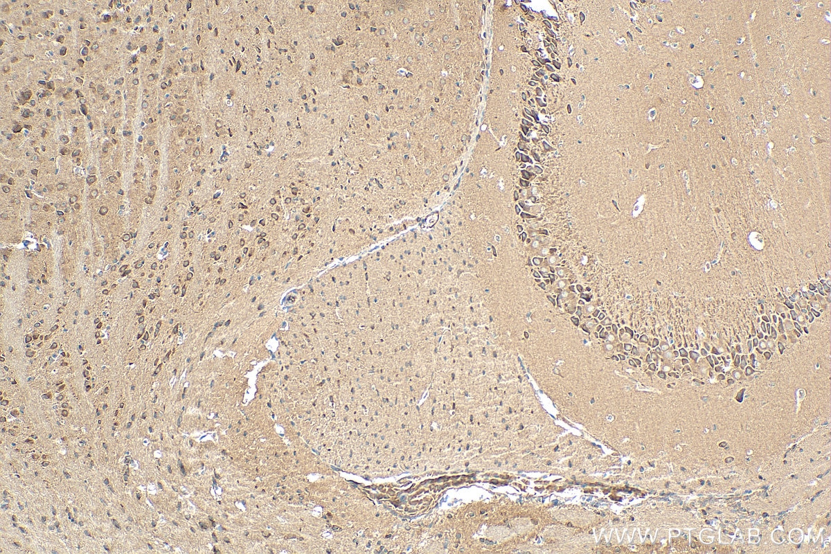 Immunohistochemistry (IHC) staining of mouse brain tissue using STRN Polyclonal antibody (21624-1-AP)