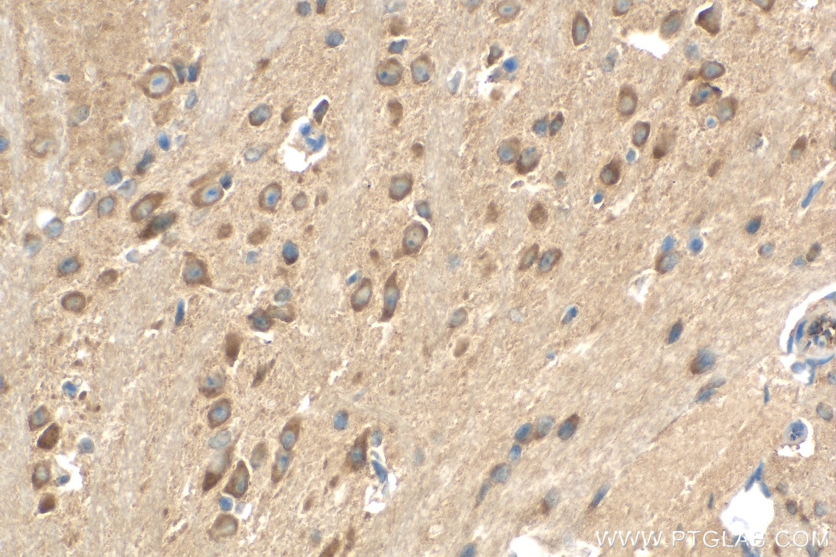 Immunohistochemistry (IHC) staining of mouse brain tissue using STRN Polyclonal antibody (21624-1-AP)