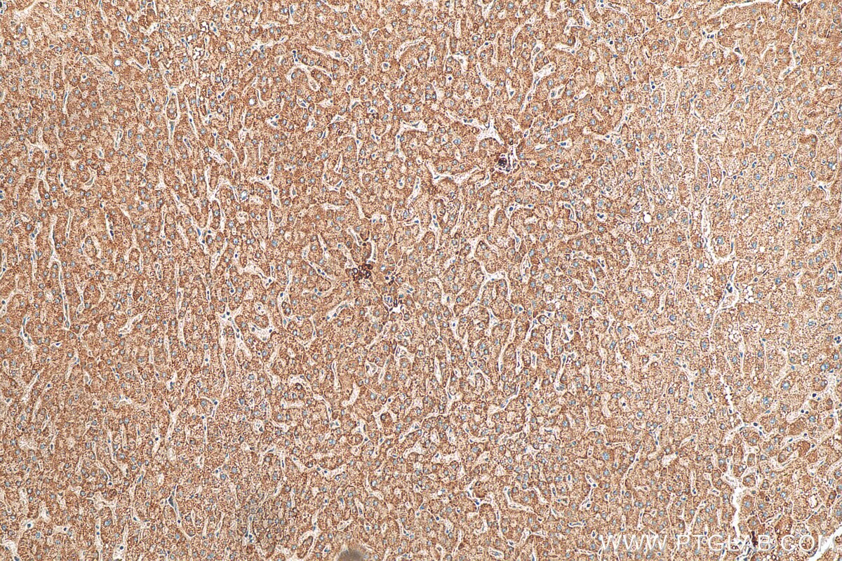 Immunohistochemistry (IHC) staining of human liver tissue using STRN Polyclonal antibody (21624-1-AP)