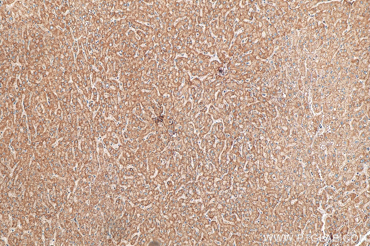 Immunohistochemistry (IHC) staining of human liver tissue using STRN Polyclonal antibody (21624-1-AP)