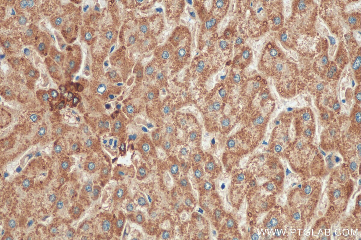 Immunohistochemistry (IHC) staining of human liver tissue using STRN Polyclonal antibody (21624-1-AP)