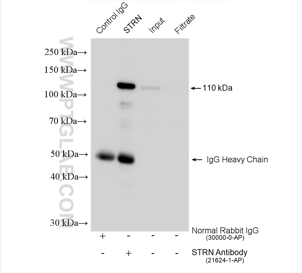 Immunoprecipitation (IP) experiment of mouse brain tissue using STRN Polyclonal antibody (21624-1-AP)