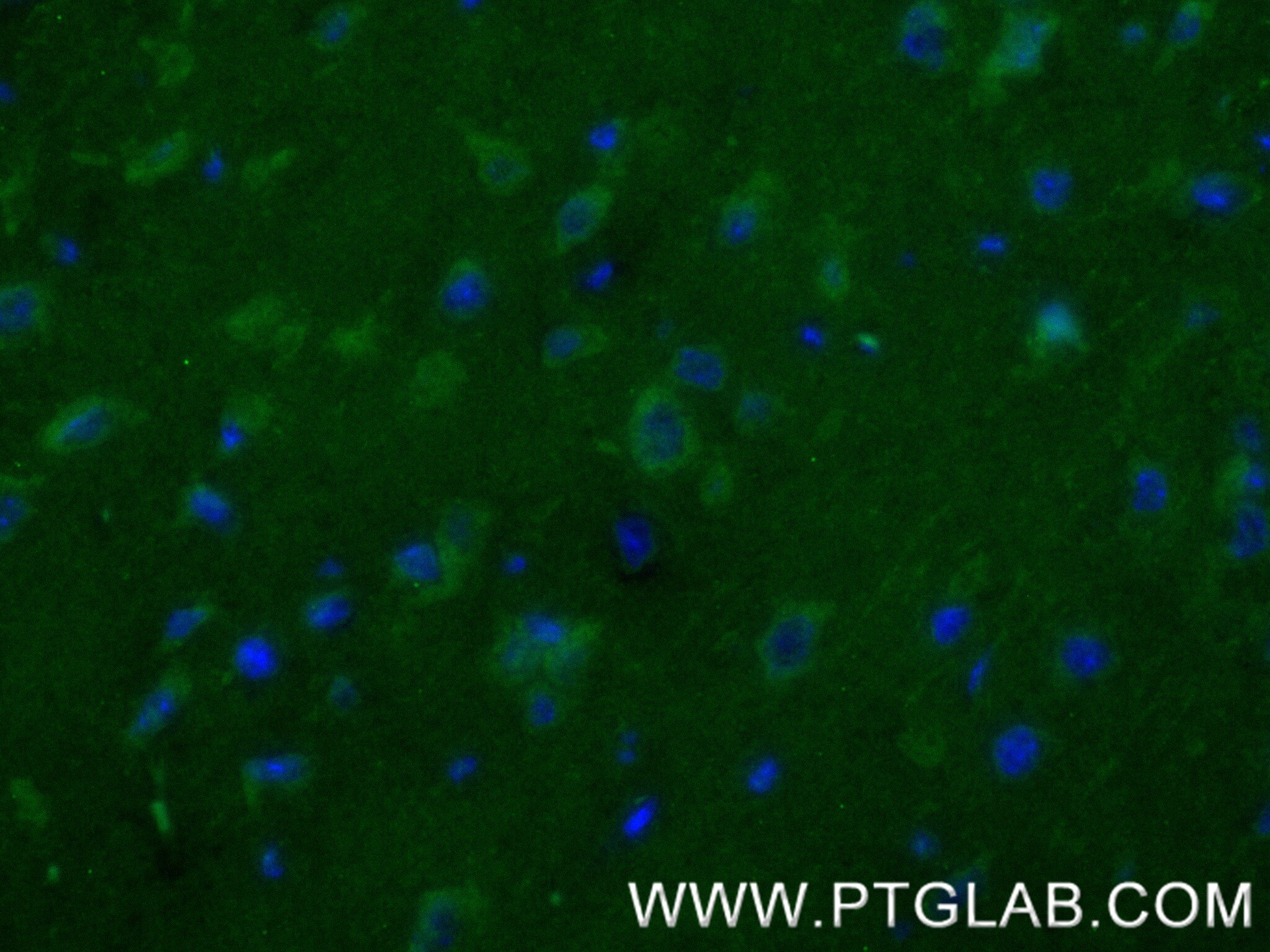 Immunofluorescence (IF) / fluorescent staining of mouse brain tissue using STRN Recombinant antibody (85058-4-RR)