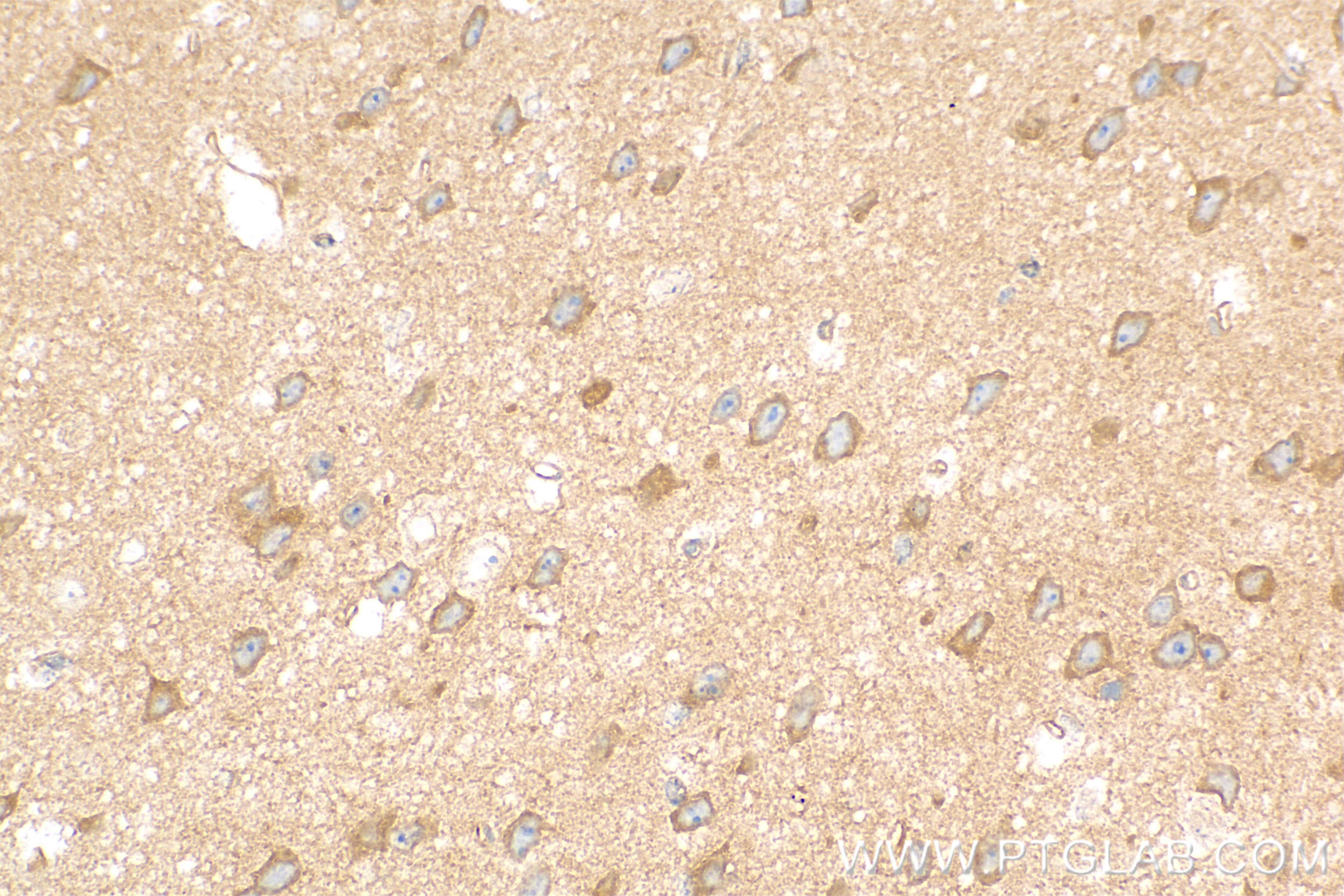 Immunohistochemistry (IHC) staining of mouse brain tissue using STRN Recombinant antibody (85058-4-RR)