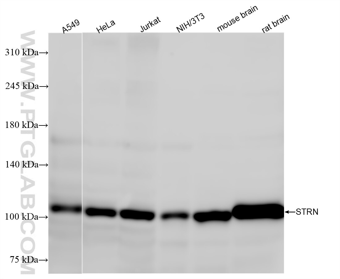 Western Blot (WB) analysis of various lysates using STRN Recombinant antibody (85058-4-RR)