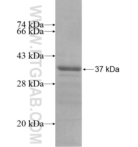 STRN fusion protein Ag15984 SDS-PAGE