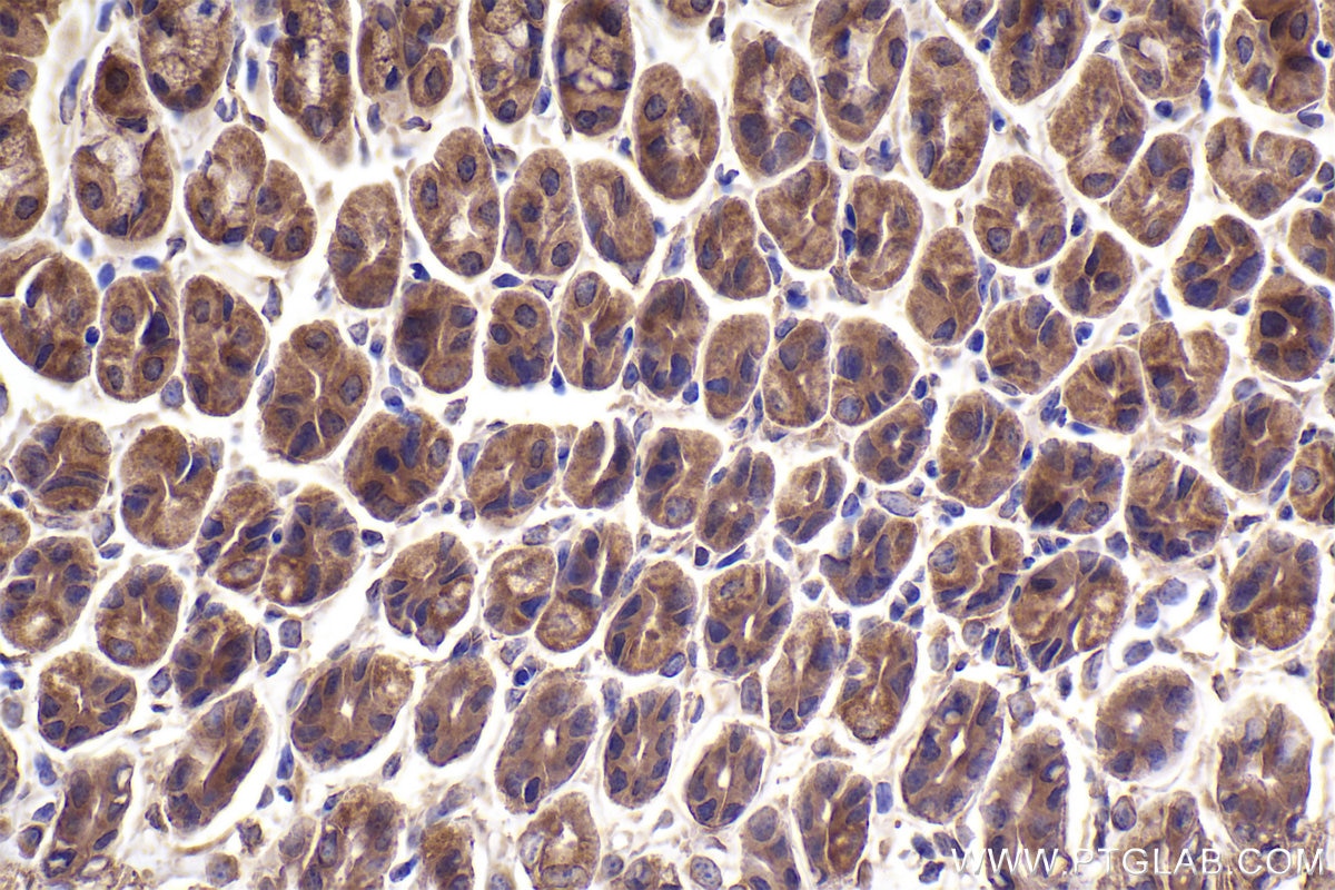 Immunohistochemistry (IHC) staining of mouse stomach tissue using STRN3 Polyclonal antibody (23966-1-AP)