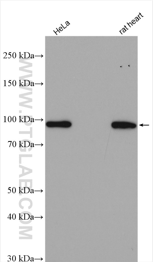 Western Blot (WB) analysis of various lysates using STRN3 Polyclonal antibody (23966-1-AP)