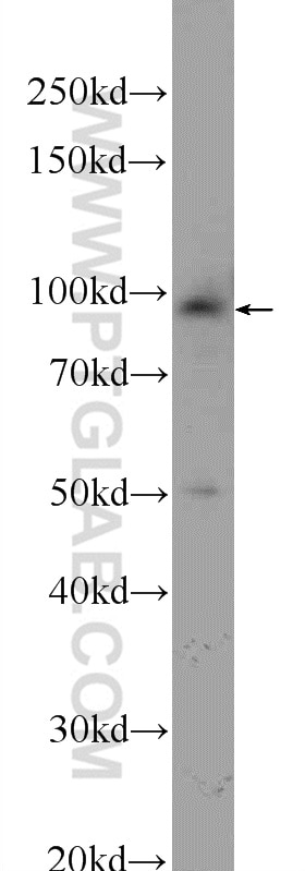 Western Blot (WB) analysis of HeLa cells using STRN3 Polyclonal antibody (23966-1-AP)