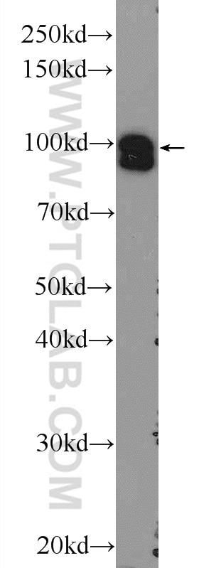 Western Blot (WB) analysis of rat brain tissue using STRN3 Polyclonal antibody (23966-1-AP)