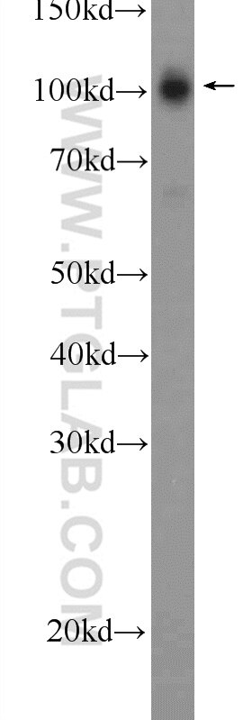 Western Blot (WB) analysis of mouse brain tissue using STRN3 Polyclonal antibody (23966-1-AP)