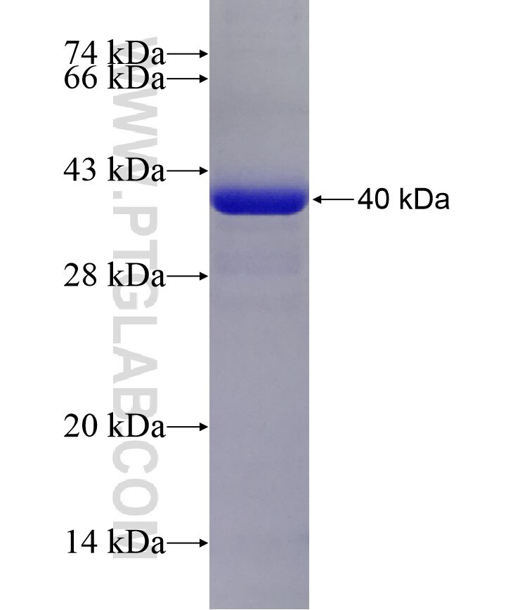 STRN3 fusion protein Ag21091 SDS-PAGE