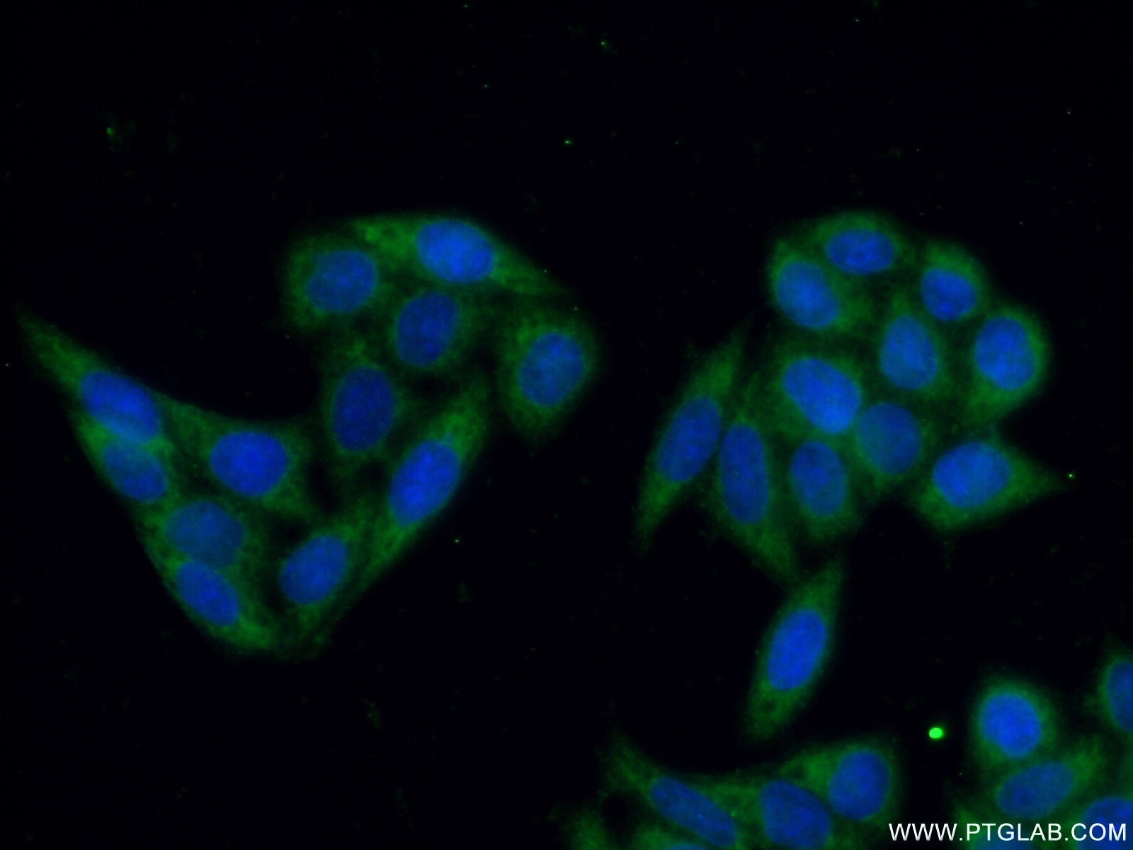 Immunofluorescence (IF) / fluorescent staining of HeLa cells using STS Polyclonal antibody (17870-1-AP)
