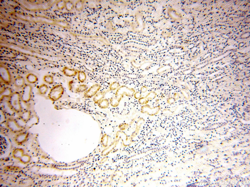 Immunohistochemistry (IHC) staining of human kidney tissue using STS Polyclonal antibody (17870-1-AP)