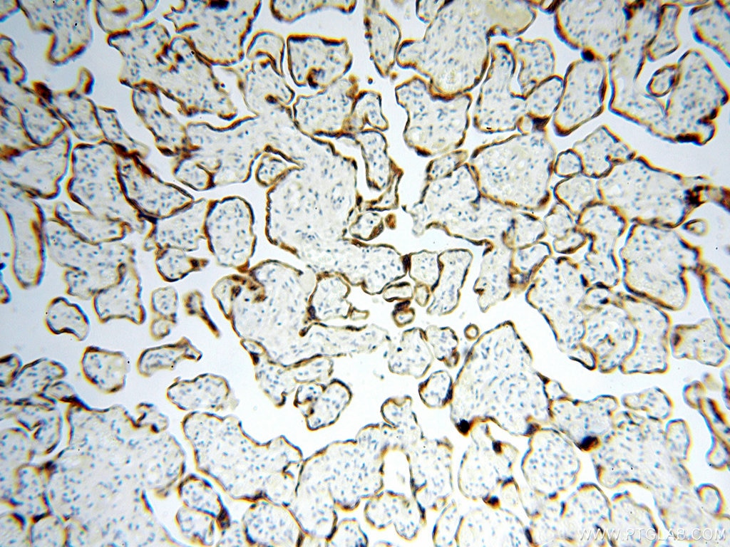 IHC staining of human placenta using 17870-1-AP
