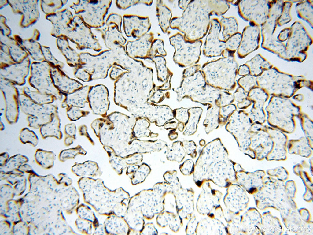 Immunohistochemistry (IHC) staining of human placenta tissue using STS Polyclonal antibody (17870-1-AP)