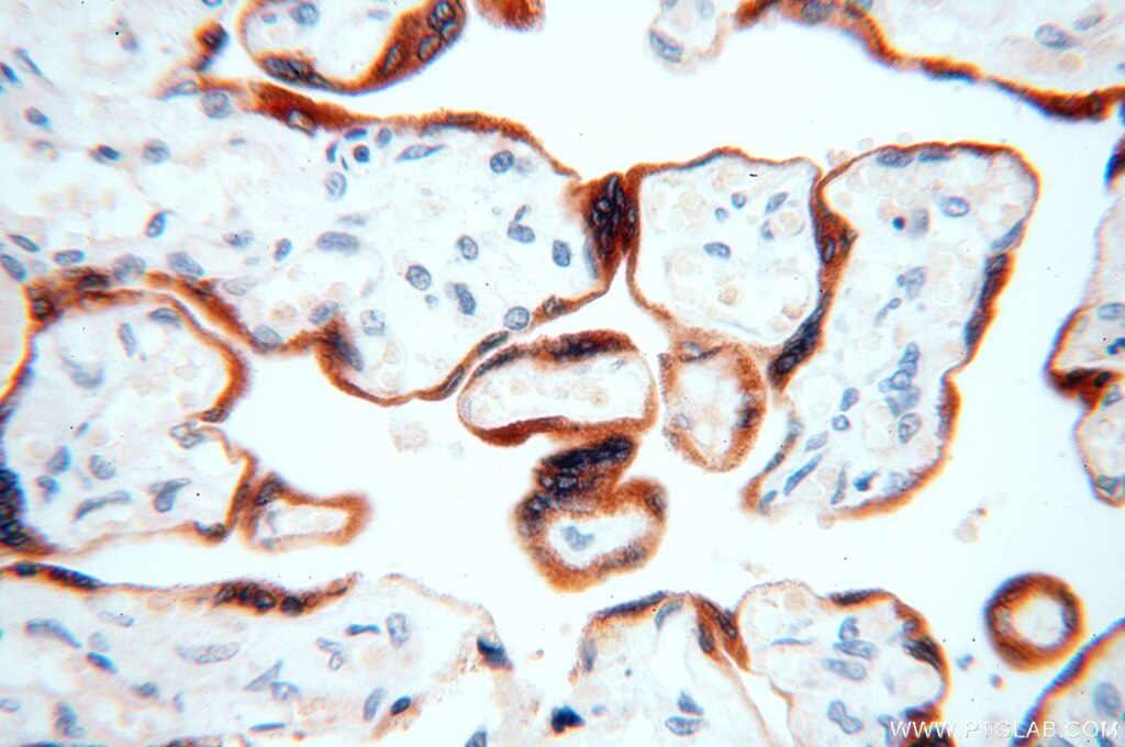 Immunohistochemistry (IHC) staining of human placenta tissue using STS Polyclonal antibody (17870-1-AP)