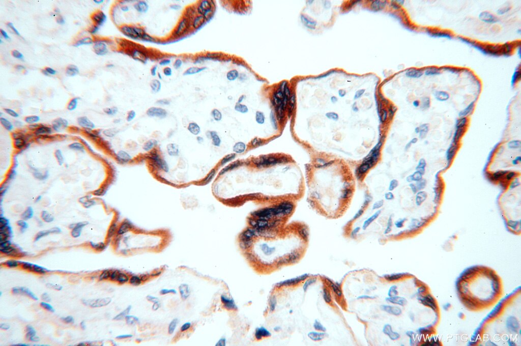 Immunohistochemistry (IHC) staining of human placenta tissue using STS Polyclonal antibody (17870-1-AP)