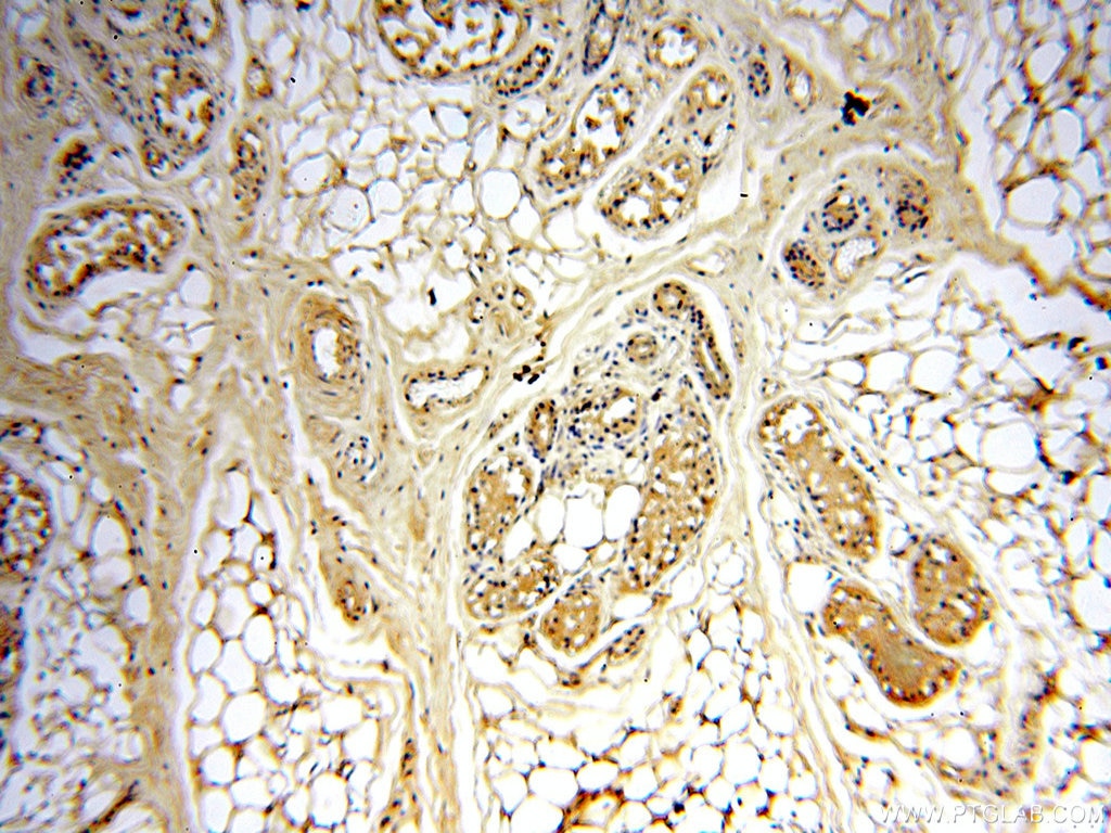 Immunohistochemistry (IHC) staining of human skin tissue using STS Polyclonal antibody (17870-1-AP)