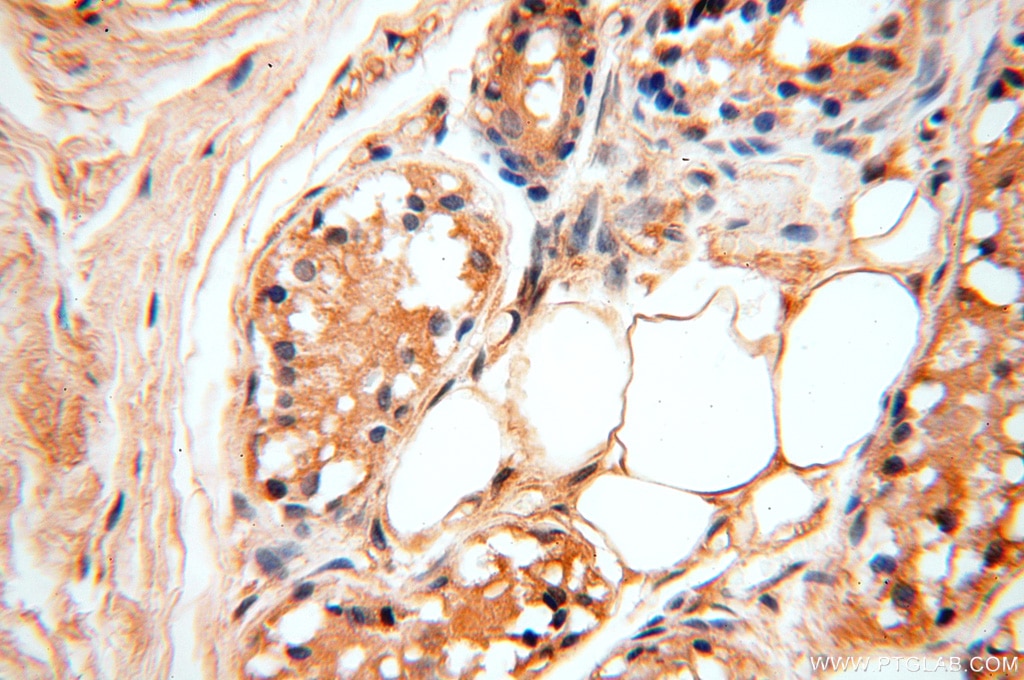 Immunohistochemistry (IHC) staining of human skin tissue using STS Polyclonal antibody (17870-1-AP)